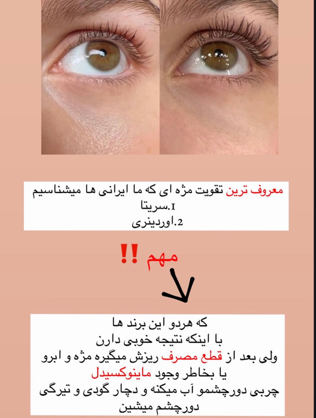 تقویت مژه و ابرو ماوالا سوئیسی